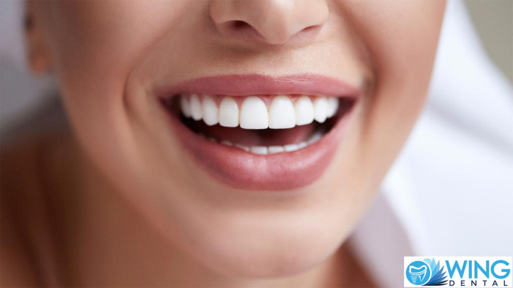 A close up of a smile.